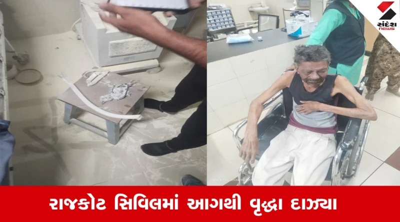 Rajkot News : રાજકોટ સિવિલ હોસ્પિટલમાં વેન્ટિલેટરમાં લાગેલી આગના કારણે વૃદ્ધ દર્દી મોઢાના ભાગે દાઝી ગયા