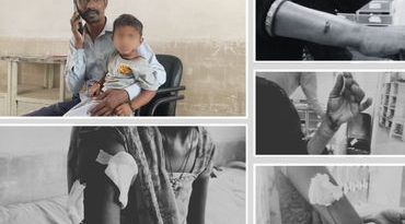 અમરેલીમાં હડકાયા શ્વાનનો આતંક: ખાંભાના ચકરાવા ગામે બાળકો અને મહિલાઓ સહિત 6 લોકોને બચકા ભર્યા