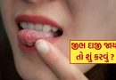 Tongue Burn Remedies : ગરમા ગરમ ચા પીધા પછી જીભ બળી જાય તો શું કરવું? જાણી લો