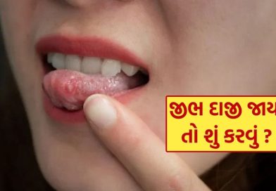 Tongue Burn Remedies : ગરમા ગરમ ચા પીધા પછી જીભ બળી જાય તો શું કરવું? જાણી લો