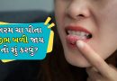 Home Remedies: ચા પીવાથી જીભ આકસ્મિક રીતે બળી જાય તો શું કરવું? આ ઘરગથ્થુ ઉપચાર અપનાવો