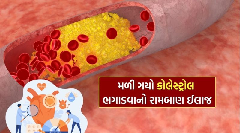Cholesterol : બજારમાં માત્ર 20 રૂપિયામાં મળતી આ શાકભાજી ઘટાડશે તમારું કોલેસ્ટ્રોલ, જાણી લો