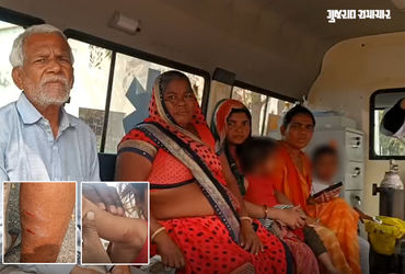 અમરેલીના મોટા લીલીયા ગામે શ્વાનોનો આતંક, 6 લોકો અને 8 પશુઓને બચકા ભર્યા