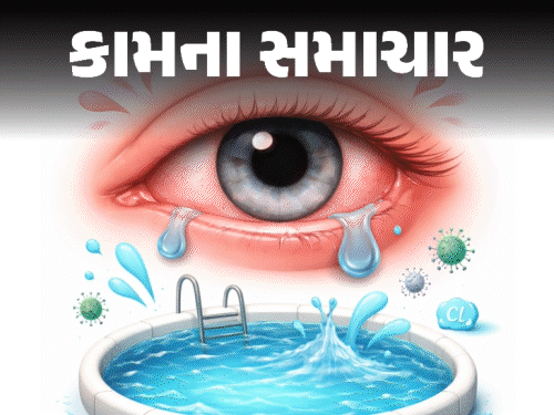જો જો, સ્વિમિંગ પૂલની મજા આંખોની સજા ન બની જાય!:12 સામાન્ય ભૂલોથી બચો, ડૉક્ટર પાસેથી જાણો 7 આઈ સેફ્ટી ટિપ્સ