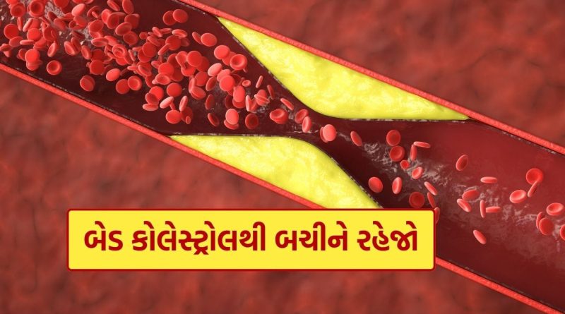 High Bad Cholesterol : શું તમે પણ હાઈ બેડ કોલેસ્ટ્રોલના શિકાર છો? આજે જ આ વસ્તુ ખાવાનું બંધ કરો