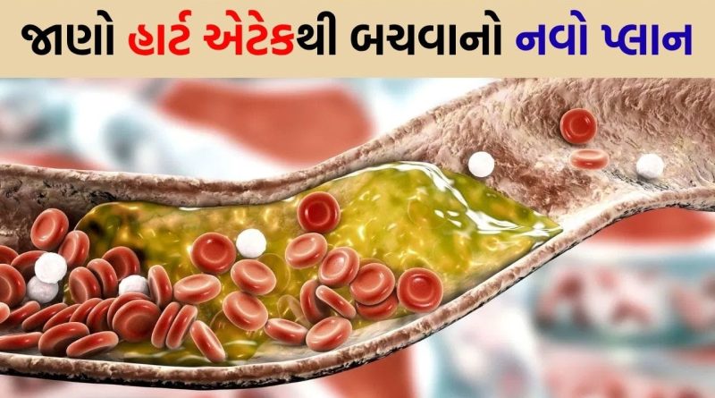 કોલેસ્ટ્રોલની નવી ગાઈડલાઈન્સે દુનિયાને ચોંકાવી ! તમારી નસોમાં સાયલન્ટ કિલરની જેમ જામી રહ્યું છે ફેટ…