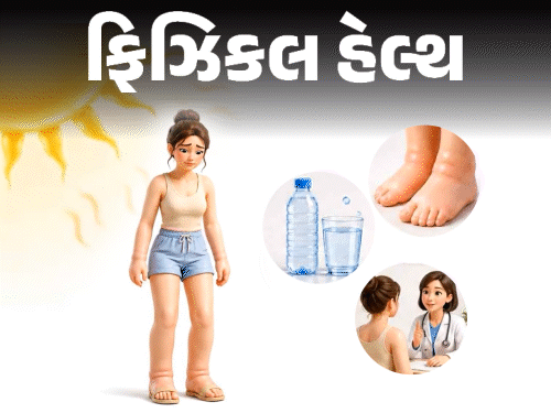 ઉનાળામાં હાથ-પગમાં સોજા ચડી જાય છે?:ગરમીના પારાની જેમ ‘હીટ એડિમા’ના કેસ વધે છે; જાણો લક્ષણો, કોને વધુ જોખમ, બચાવ માટેના જરૂરી પગલાં