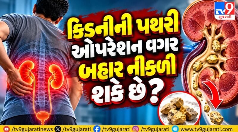 ઓપરેશન વગર પણ નીકળી શકે છે કિડનીની પથરી, જાણો કેટલા mmની પથરીમાં સર્જરી જરૂરી અને ક્યારે દવા-પાણીથી થાય છે ઈલાજ !